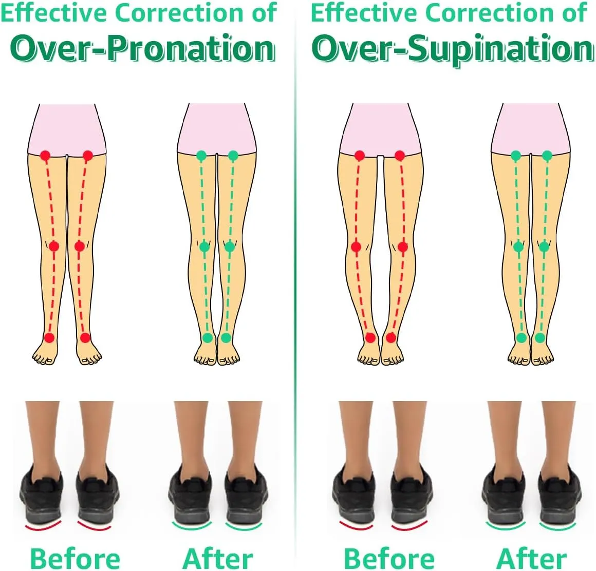 Skyfoot 3 Layers Adjustable Heel Wedge Inserts for Supination & Pronation Correction, Adhesive Medial & Lateral Heel Insoles for Bow Legs, Knee Pain, Foot Alignment (S: W 4-6.5, M 5-6.5, Crystal)